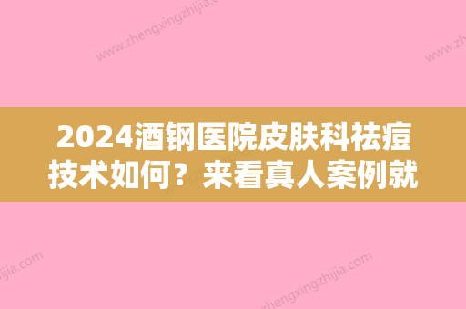 2024酒钢医院皮肤科祛痘技术如何？来看真人案例就知道了