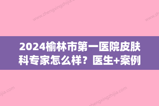 2024榆林市第一医院皮肤科专家怎么样？医生+案例介绍(榆林三甲医院皮肤科)