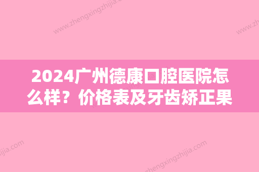 2024广州德康口腔医院怎么样？价格表及牙齿矫正果图