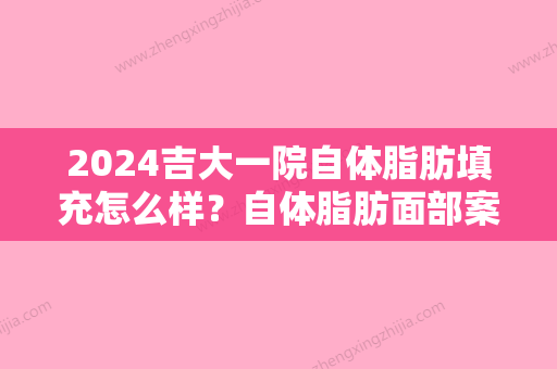 2024吉大一院自体脂肪填充怎么样？自体脂肪面部案例来咯~求评价