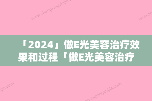 「2024」做E光美容治疗效果和过程「做E光美容治疗术效果可持续多久」