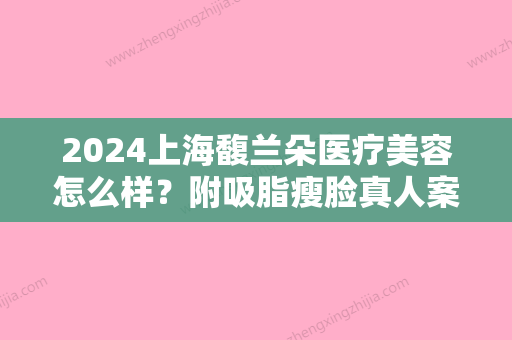 2024上海馥兰朵医疗美容怎么样？附吸脂瘦脸真人案例分享及2024价格表公开