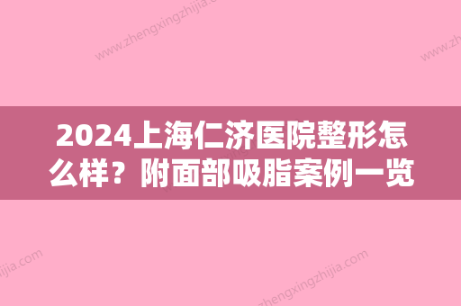 2024上海仁济医院整形怎么样？附面部吸脂案例一览及2024价格表上线