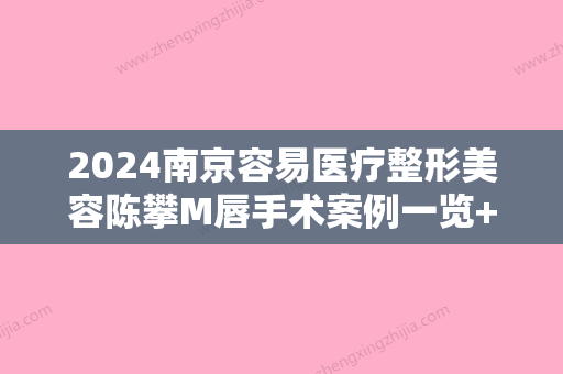 2024南京容易医疗整形美容陈攀M唇手术案例一览+2024价格表曝光