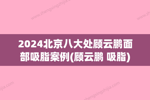 2024北京八大处顾云鹏面部吸脂案例(顾云鹏 吸脂)