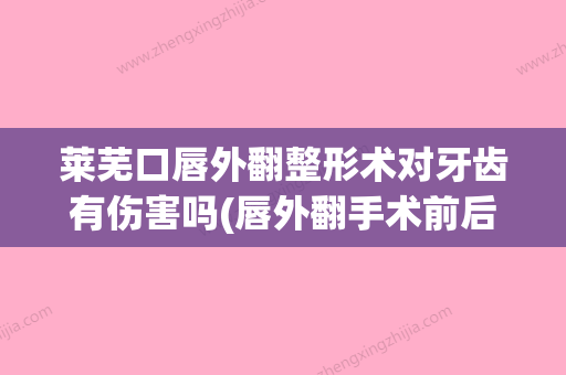 莱芜口唇外翻整形术对牙齿有伤害吗(唇外翻手术前后对比) - 整形之家