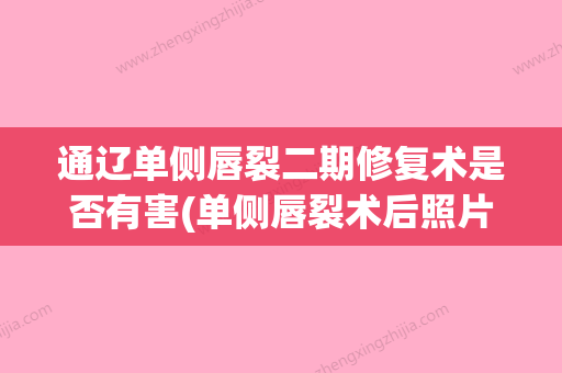 通辽单侧唇裂二期修复术是否有害(单侧唇裂术后照片) - 整形之家