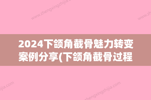 2024下颌角截骨魅力转变案例分享(下颌角截骨过程)