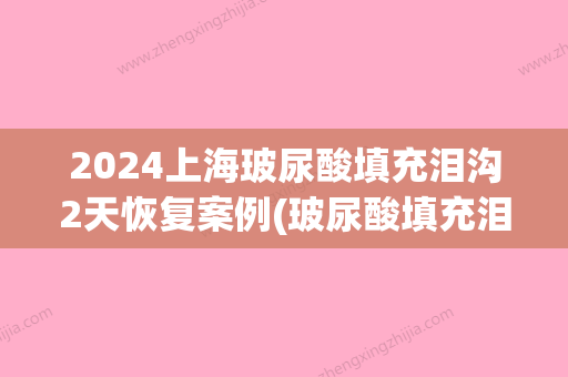 2024上海玻尿酸填充泪沟2天恢复案例(玻尿酸填充泪沟多久恢复)