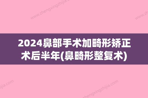 2024鼻部手术加畸形矫正术后半年(鼻畸形整复术)