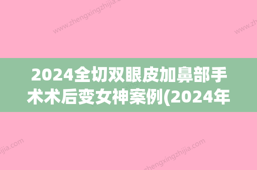 2024全切双眼皮加鼻部手术术后变女神案例(2024年割双眼皮)