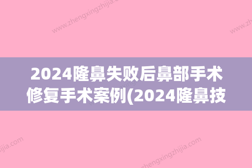 2024隆鼻失败后鼻部手术修复手术案例(2024隆鼻技术)