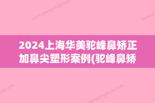 2024上海华美驼峰鼻矫正加鼻尖塑形案例(驼峰鼻矫正手术)