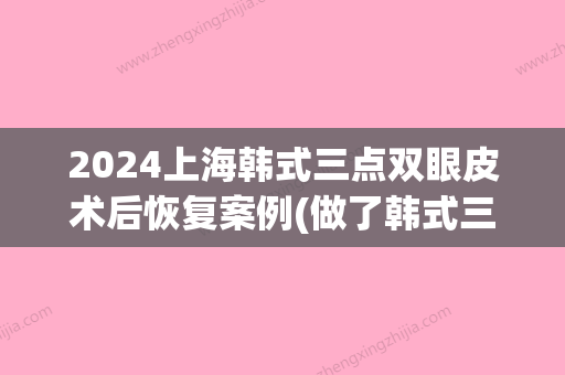 2024上海韩式三点双眼皮术后恢复案例(做了韩式三点双眼皮想拆了)