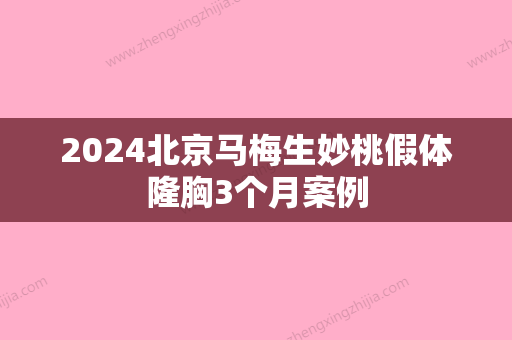 2024北京马梅生妙桃假体隆胸3个月案例