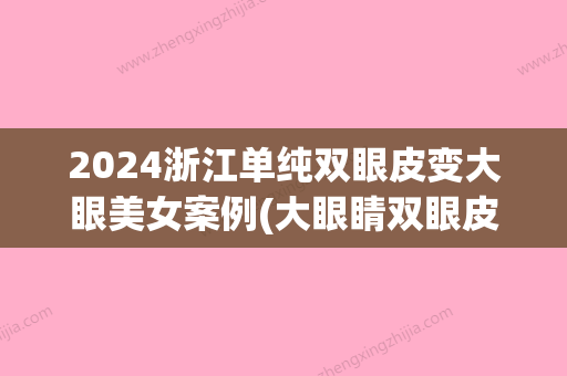 2024浙江单纯双眼皮变大眼美女案例(大眼睛双眼皮女孩照片)