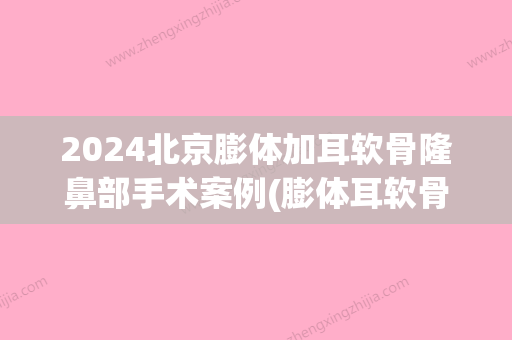 2024北京膨体加耳软骨隆鼻部手术案例(膨体耳软骨隆鼻价格)