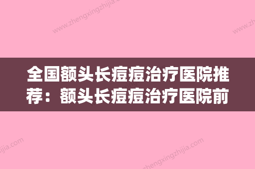 全国额头长痘痘治疗医院推荐：额头长痘痘治疗医院前50揭露(额头长痘痘去医院应该挂什么科) - 整形之家