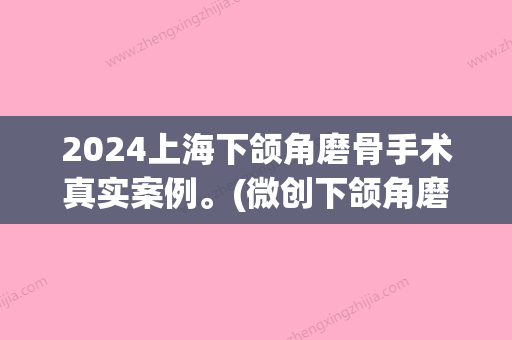 2024上海下颌角磨骨手术真实案例。(微创下颌角磨骨术)