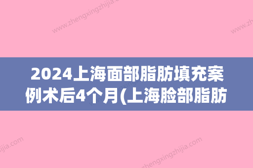 2024上海面部脂肪填充案例术后4个月(上海脸部脂肪填充)