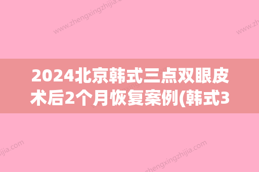 2024北京韩式三点双眼皮术后2个月恢复案例(韩式3点双眼皮恢复照)