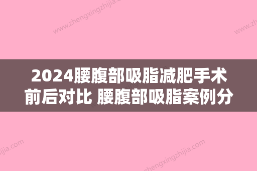 2024腰腹部吸脂减肥手术前后对比 腰腹部吸脂案例分享