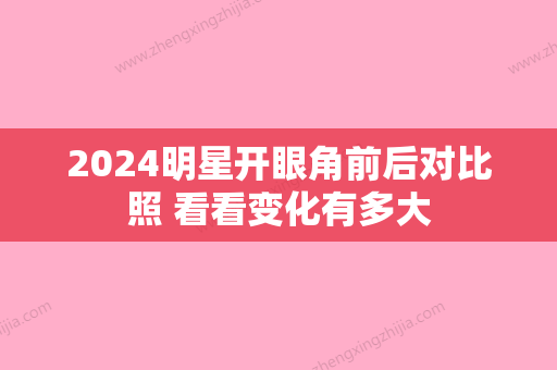 2024明星开眼角前后对比照 看看变化有多大