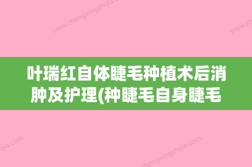 叶瑞红自体睫毛种植术后消肿及护理(种睫毛自身睫毛会掉吗) - 整形之家