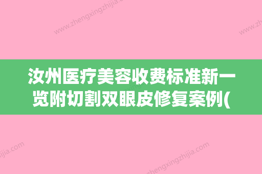 汝州医疗美容收费标准新一览附切割双眼皮修复案例(汝州哪家医院做双眼皮好) - 整形之家