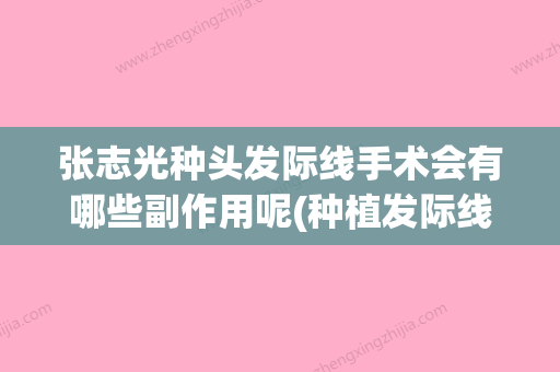 张志光种头发际线手术会有哪些副作用呢(种植发际线手术价格) - 整形之家