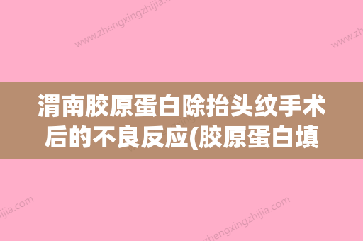 渭南胶原蛋白除抬头纹手术后的不良反应(胶原蛋白填充抬头纹多少钱) - 整形之家