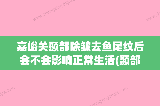 嘉峪关颞部除皱去鱼尾纹后会不会影响正常生活(颞部除皱手术适合哪些人做?(图)) - 整形之家