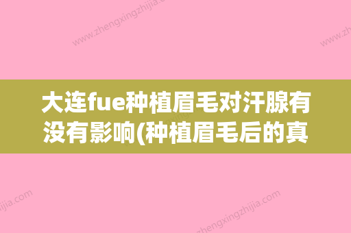 大连fue种植眉毛对汗腺有没有影响(种植眉毛后的真实案例) - 整形之家