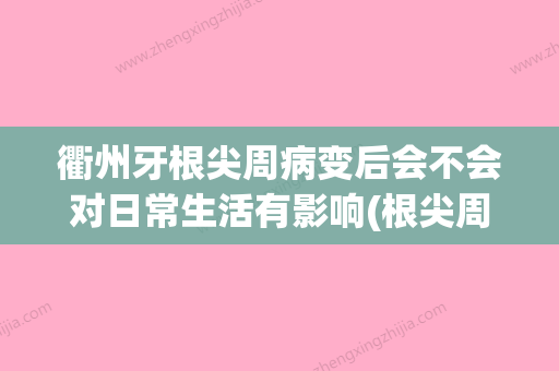 衢州牙根尖周病变后会不会对日常生活有影响(根尖周炎导致牙周病变的临床表现) - 整形之家