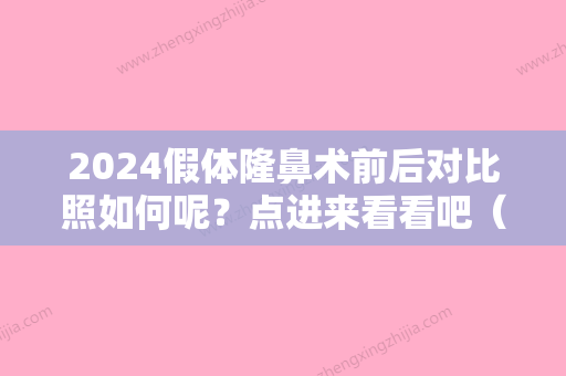 2024假体隆鼻术前后对比照如何呢？点进来看看吧（假体隆鼻效果图对比）