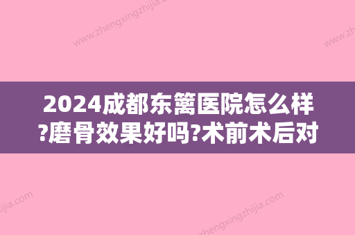 2024成都东篱医院怎么样?磨骨效果好吗?术前术后对比图