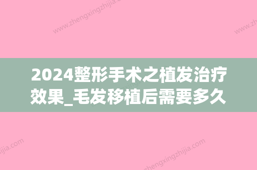 2024整形手术之植发治疗效果_毛发移植后需要多久改善效果更佳(2024年植发新技术)