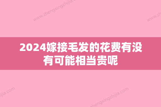 2024嫁接毛发的花费有没有可能相当贵呢