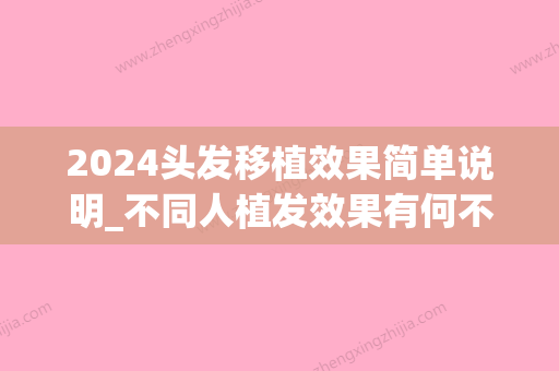 2024头发移植效果简单说明_不同人植发效果有何不同(2024新植发技术)