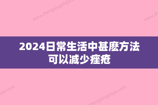 2024日常生活中甚麽方法可以减少痤疮