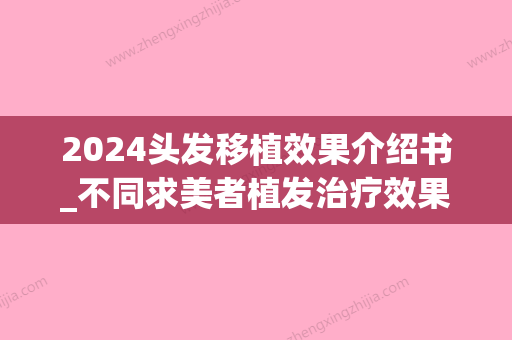 2024头发移植效果介绍书_不同求美者植发治疗效果有何差异(2024植发新技术是什么)