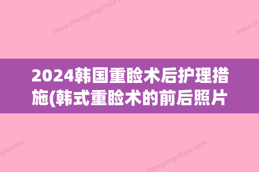 2024韩国重睑术后护理措施(韩式重睑术的前后照片)