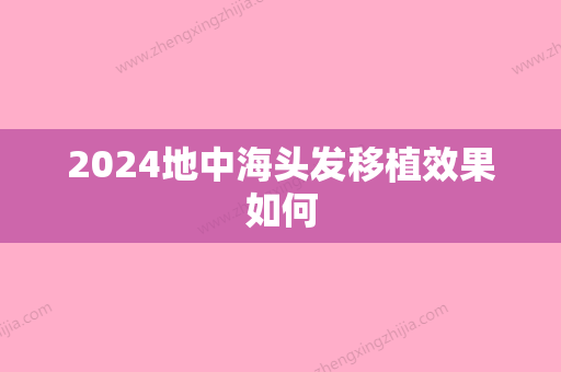 2024地中海头发移植效果如何