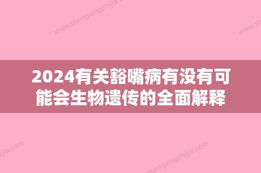 2024有关豁嘴病有没有可能会生物遗传的全面解释