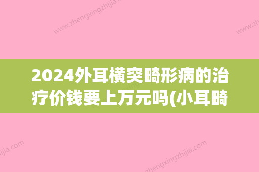 2024外耳横突畸形病的治疗价钱要上万元吗(小耳畸形手术费2024)