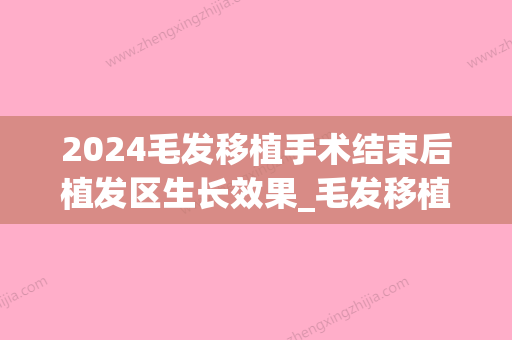 2024毛发移植手术结束后植发区生长效果_毛发移植手术后改善效果到底怎么样