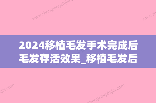 2024移植毛发手术完成后毛发存活效果_移植毛发后植发效果好不好