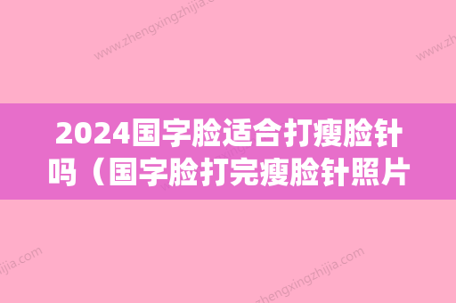 2024国字脸适合打瘦脸针吗（国字脸打完瘦脸针照片）(打完瘦脸针变成国字脸)