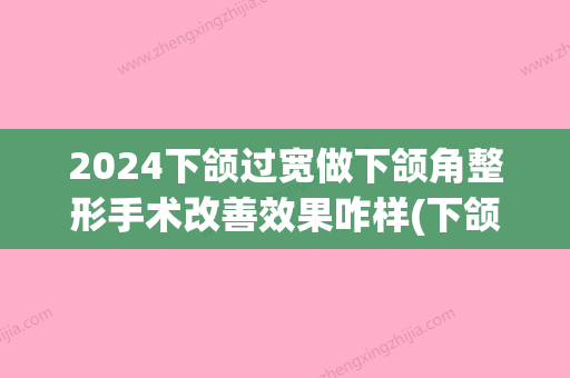 2024下颌过宽做下颌角整形手术改善效果咋样(下颌角整形恢复期)