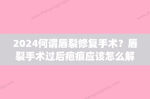 2024何谓唇裂修复手术？唇裂手术过后疤痕应该怎么解决？(唇裂手术后疤痕半年可以恢复吗)